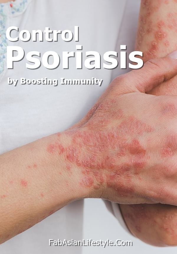 Control Psoriasis by Boosting Immunity